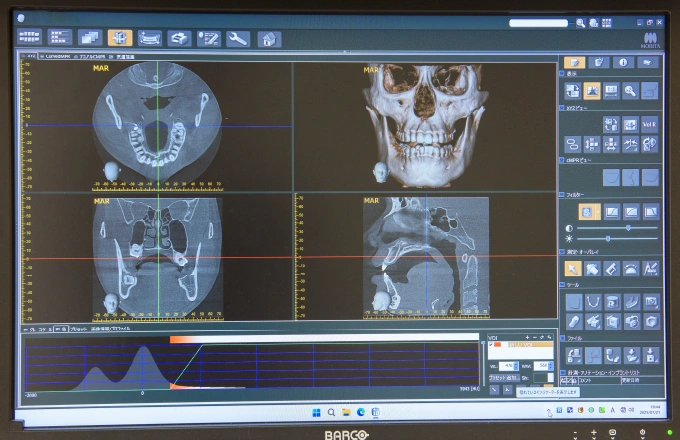 [写真]より的確な診断が可能な歯科用CTでの検査も行っています 。3