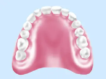 [写真]保険適応の総義歯